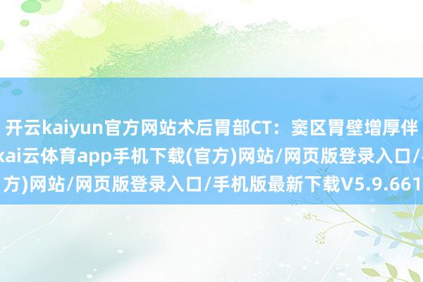 开云kaiyun官方网站术后胃部CT:窦区胃壁增厚伴周围淋凑趣儿(图1D-kai云体育app手机下载(官方)网站/网页版登录入口/手机版最新下载V5.9.661